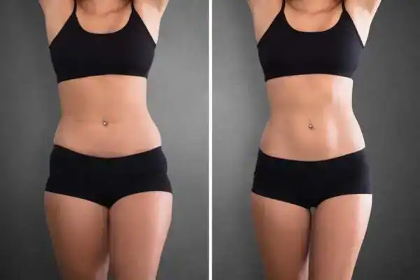 6 Diastasis Recti Pregnancy Mistakes That Make Recovery Harder Than It Needs to Be, Full Guide To Safeguard Post-Pregnancy Issues 4 tonesculpt